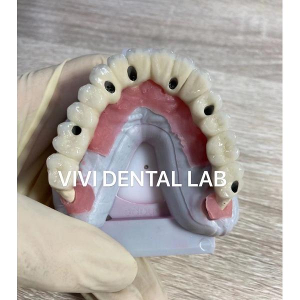 Quality Screw Implant Digital Dental Crowns And Bridge Scheftner Ivoclar Translucency for sale