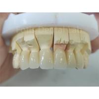 China Dental Product Zirconia Layered With Porcelain Easy Maintenance factory