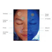 china 45W Power Smart Skin Analyzer Machine PDF Print for Doctor Beauty Salon
