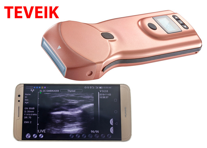 China Color Doppler Wireless Ultrasound Probe Wifi ultrasound for Iphone / Android / USB for sale