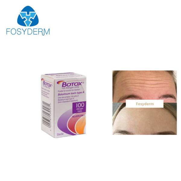 Quality 100Units Allergan Botulinum Toxion For Remove Facial Wrinkles Botox Type A for sale