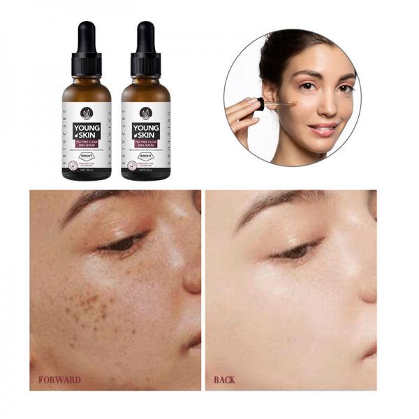 Quality 1oz/30ml OEM Organic Tea Tree Relief Essence Face Serum Repair Acne Pimple for sale
