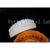 China Porcelain Dental Lab Veneers Bonding Cement For Long Lasting Restorations factory
