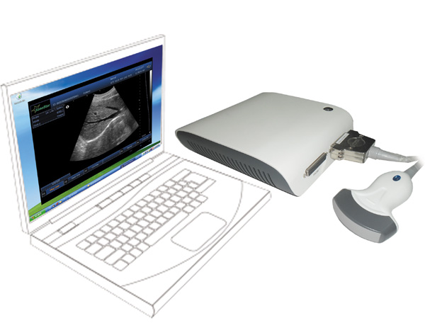 China Computer base ultrasound scanner ultrasound machine ultrasound scanner box with 3D image black and white factory