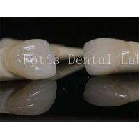 China Long-lasting Dental Lab Laminate Veneers Customizable for Various Tooth Preparations factory
