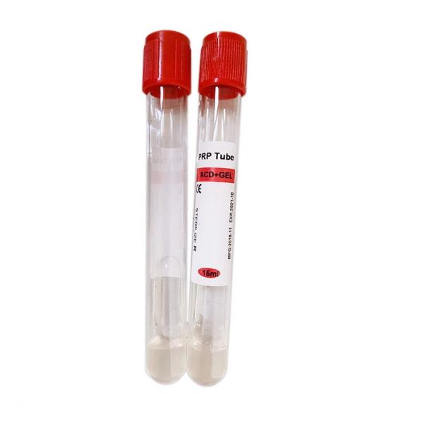 Quality Serum Plasma Blood Sample Collection Tubes  Pollution Free Eco Friendly for sale