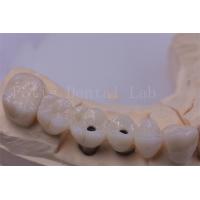 China Titanium / Zirconia Dental Crown Silver Polished For Missing Teeth factory