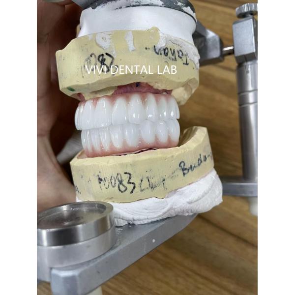 Quality Screwed All On Four Zirconia Bridge Ivoclar Dental High Accuracy for sale