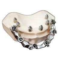 Quality FDA 3014652903 PFM bridge dental Highly Aesthetic Extremely Strong for sale