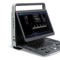 Quality 15.6'' LCD Sonoscape E2 Ultrasound Machine With 2 Year Warranty for sale