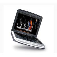 Quality FDA Approved Laptop Ultrasound Machine Chison SonoBook 8 For Echocardiography for sale