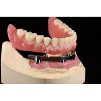 China Titanium Implant Supported Dentures Precise Ivoclar Denture Over Implants factory