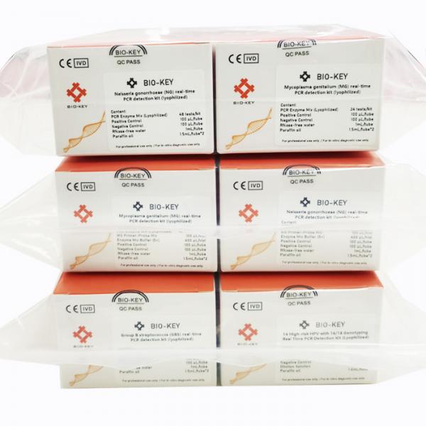 Quality Epstein Barr Virus EBV Real Time PCR Detection Kit Lyophilized 96tests/Kit for sale