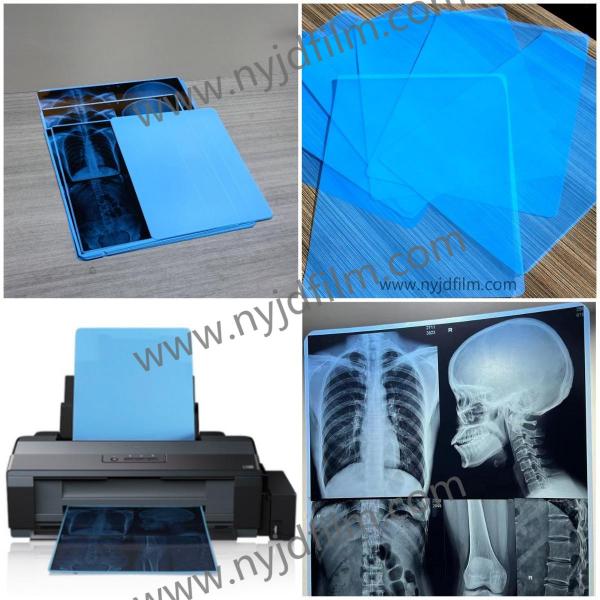 Quality 210 Microns Blue X Ray Film Medical Inkjet Printing Film For Hospital for sale