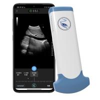 Quality Emergency Medicine MPEG-4 Handheld Ultrasound Scanner For Clinical Diagnostic for sale