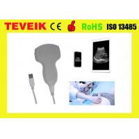 China Cheaper USB Convex Probe Mini Ultrasound Device USB ultrasound scanner For Laptop/ Mobile factory