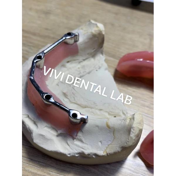 Quality Sheftner Ivoclar Implant Overdenture Bar With Preci Attachments Metal Clips for sale