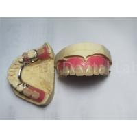 China Comfortable Peek Partial Denture / Removable Dental Prosthesis Customized factory