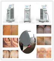 China Professional triple wave length laser hair removal 755/808/1064nm diode laser hair removal machine factory