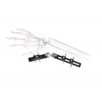 China Straight Pin Type Wrist Medical External Fixator minimal interference with soft-tissue factory