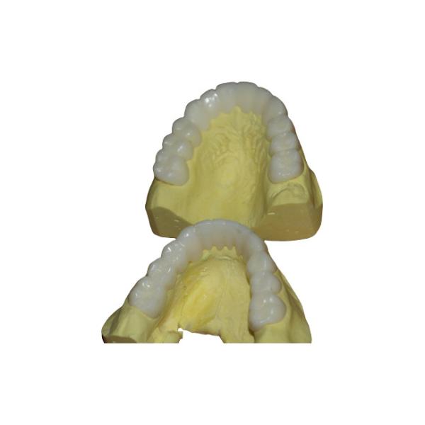 Quality Temporary PFM Dental Crown for sale