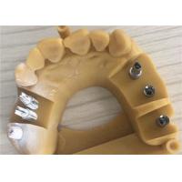 China Digital Biocompatibility PFM Dental Crown 3D Printing Temporary Crowns for sale