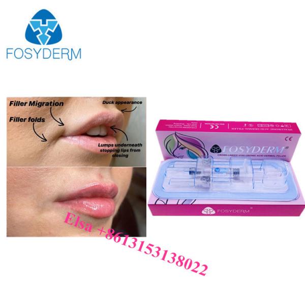 Quality Lip Cheek And Nasolabial Dermal Filler Hyaluronic acid Ha Injections 1ml 2ml 5ml for sale