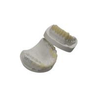 Quality Custom TEMP Porcelain Tooth Crown Inlay Onlay Strong Hardness Veneer for sale