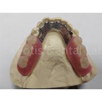 China OEM Flexible Removable Partial Denture  Easy To Clean / Maintain factory