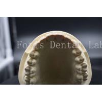 China High Strength Artificial Teeth Veneers Dentist Porcelain Veneers Natural Looking factory