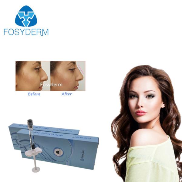 Quality Pre Filled Crosslinked Lip Fullness Fosyderm Filler for sale