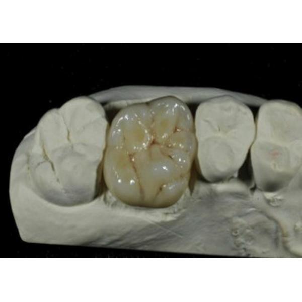 Quality CE ISO Flexible Porcelain Dental Crown For Back Teeth Restoration for sale