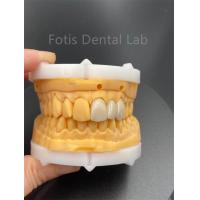 China High Durability Multilayered Zirconia Dental Ceramics For Dental Lab Medical Product factory