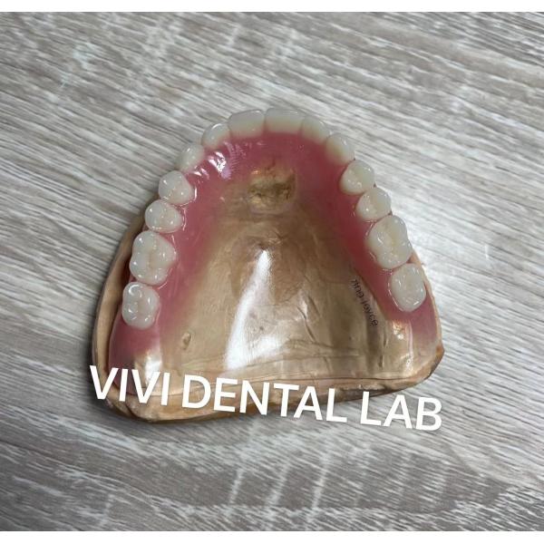Quality Removable Clear Full Acrylic Denture Retentive Natural Looking for sale