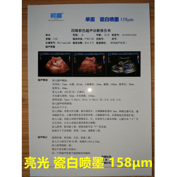 Quality 125 Microns White Base Opaque Inkjet Medical Film Three Dimensional CT Scan Film for sale