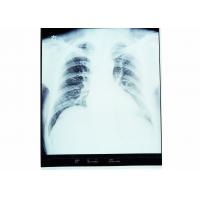 China Medical Dry Imaging Film X-ray For AGFA 5300 / 5302 / 5500 KND-A factory