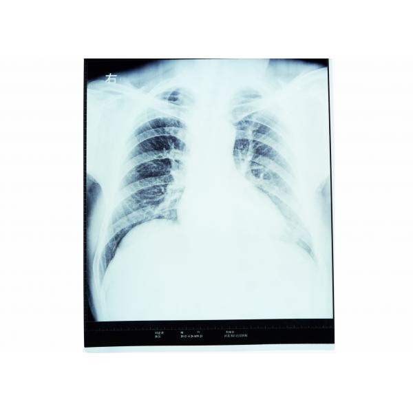 Quality Medical Dry Imaging Film X-ray For AGFA 5300 / 5302 / 5500 KND-A for sale