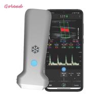 Quality 126mm Convex Probe Ultrasound Scanner For Vascular MSK Nerve for sale