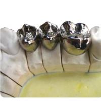 Quality Cobalt Chromium Dental Implant Crown Corrosion Resistant With High Biocompatibil for sale