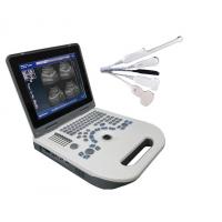 Quality ISO Mobile USG Scan Machine For Home Use 3.5MHz R60 Wearproof for sale