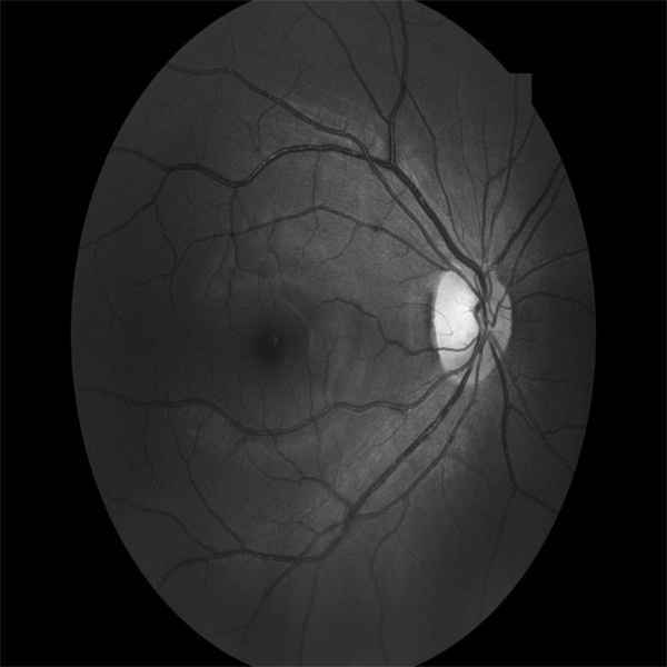 Quality FAF Non Mydriatic Fundus Camera Optical Retinal Imaging for sale