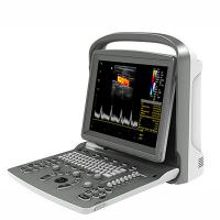 Quality 12 Inch LED Chison Portable Ultrasound Machine ECO6 With Long Battery Life for sale