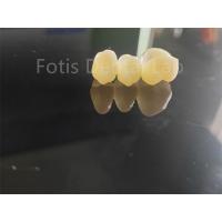 China Dental Industry Zirconia Layered With Porcelain Long Lasting Solution factory