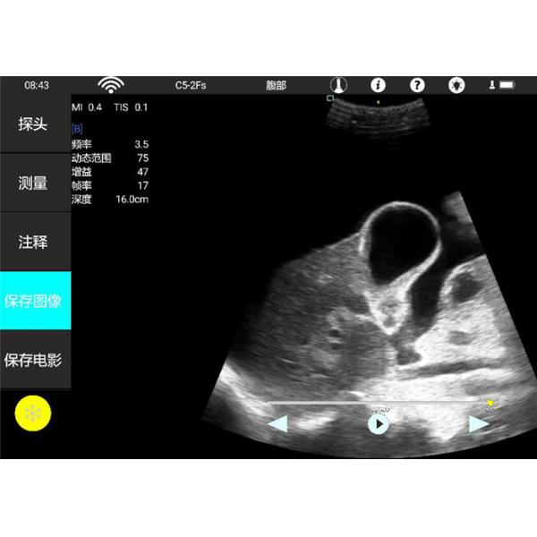 Quality Cardiac Handheld Ultrasound Machine Wireless Ultrasound Probe Human Or Vet Usage for sale