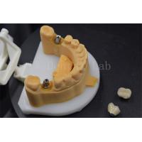 China Easy To Place Zirconia Teeth Crown Titanium Crowns For Teeth Customised factory