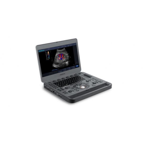 Quality Smart Sight 500GB Laptop SonoScape Ultrasound Machine With 15.6'' LCD for sale