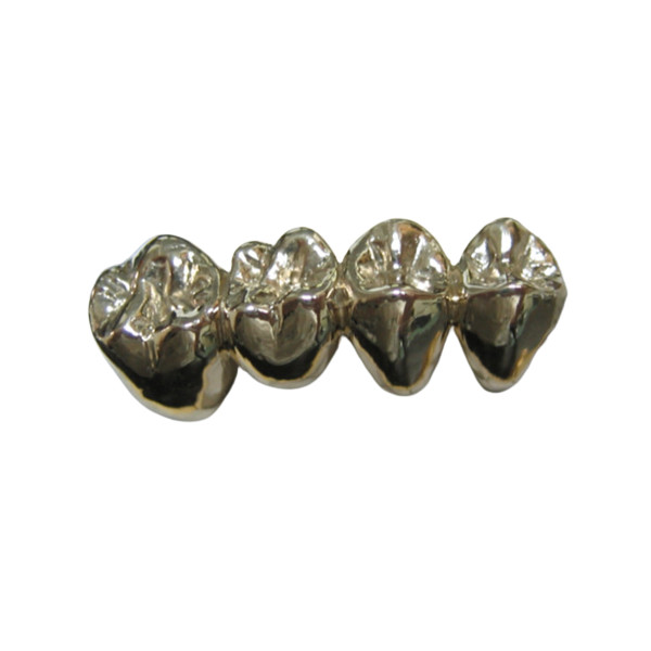 Quality High Stability Semi Precious Dental Crown Bridge PFM Easy Casting for sale