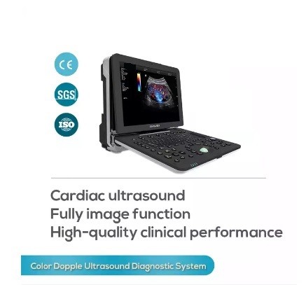 Quality Cardiovascular Cardiology Portable Full Figital Color Doppler Ultrasound Scanner for sale