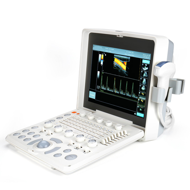 China 1024 Frame Laptop Color Doppler Device Portable Ultrasound Scanner With 2 Probe factory