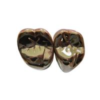 Quality High Strength FMC Metal Crown Tooth Semi Precious Metal Crown for sale